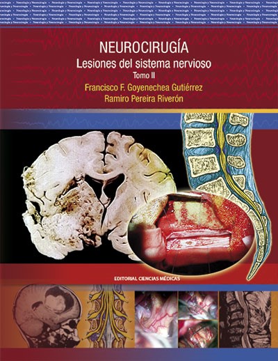 neurocirugia_lesiones02_web