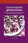 enfermedades glomerulares