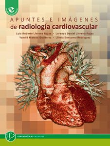 Cubierta-Apuntes-e-imágenes-de-Radiología-cardiovascular